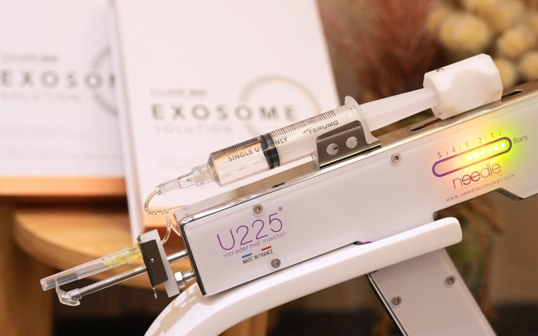 Hair Loss? URenew by U225 might be the answer!